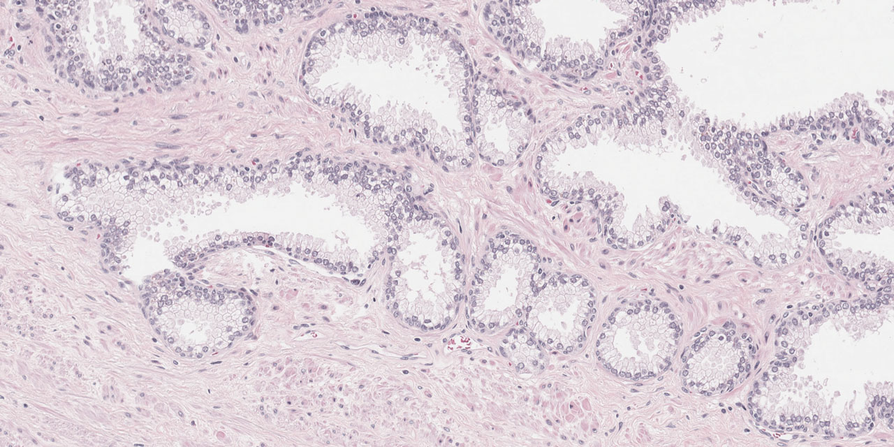 vetrino istologico digitalizzato