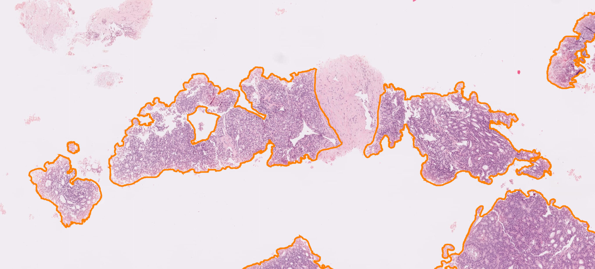 vetrino digitale analizzato assist