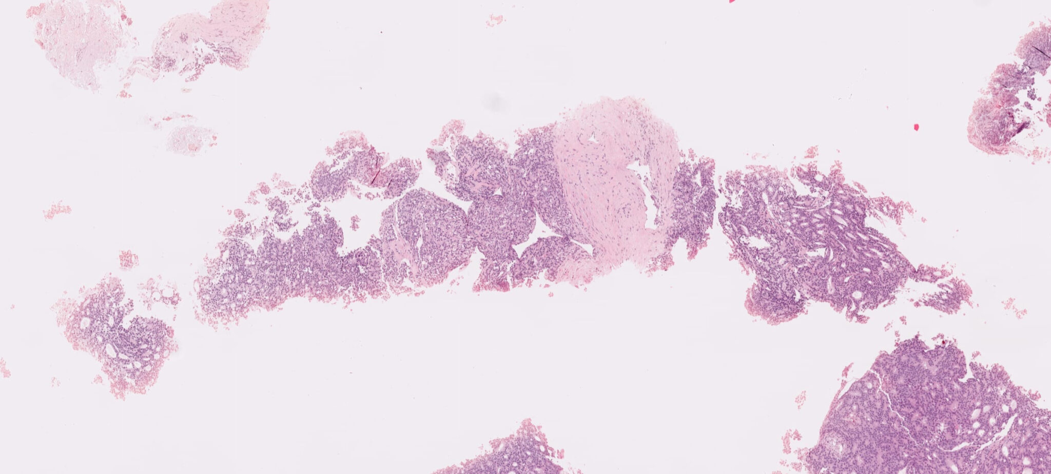 vetrino digitale normalizzato stains