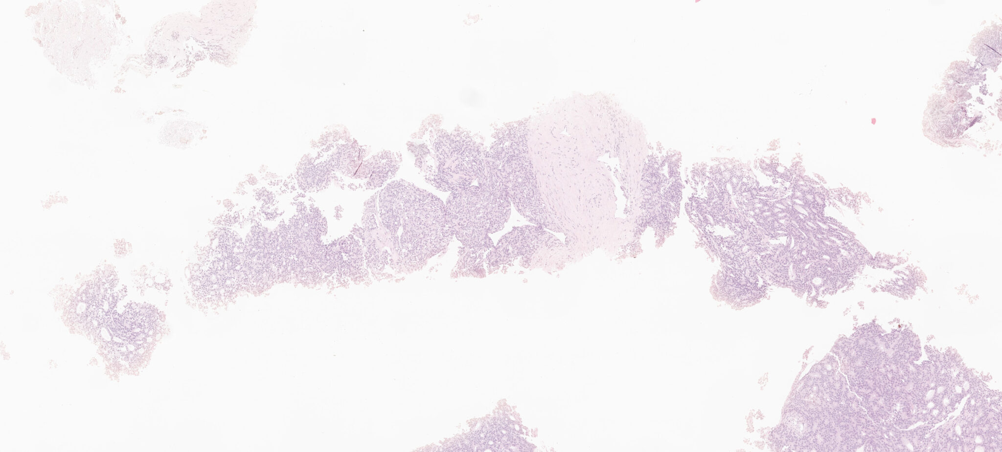 vetrino istologico digitalizzato originale